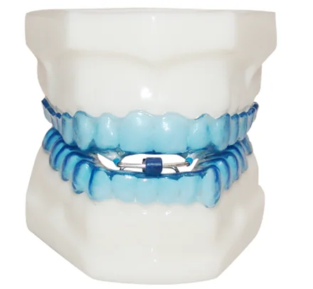 Aparelho Intraoral para Apneia do Sono visto de frente, com as duas placas encaixadas
